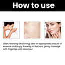 Eelhoe Skin Melanin Correcting Facial Serum Anti-Freckles Dark Spots