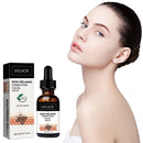Eelhoe Skin Melanin Correcting Facial Serum Anti-Freckles Dark Spots
